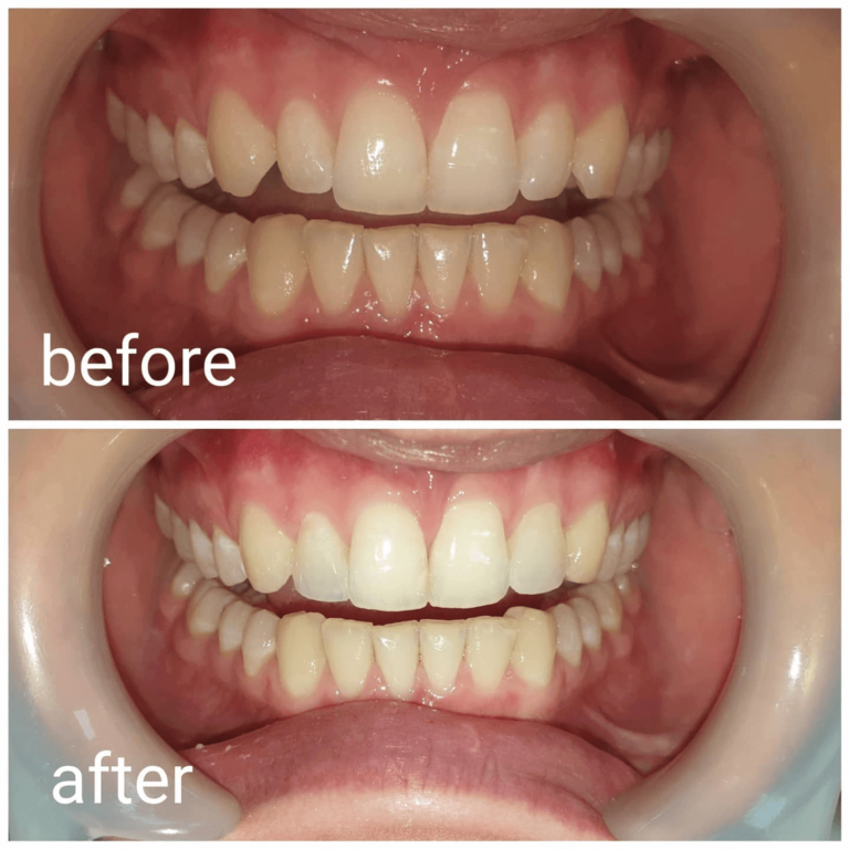 Case Studies Dentist Grinstead